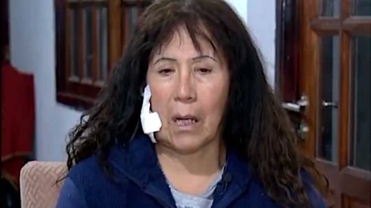 “Pensé que me estaba muriendo”: el dramático relato de la turista atacada con un ladrillazo camino a Ezeiza