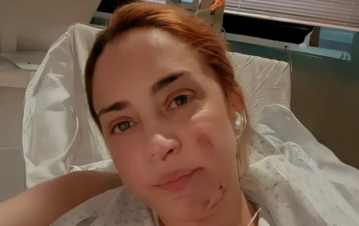 “Quemada viva”: la foto más impactante de María Julia Oliván tras someterse a 17 operaciones