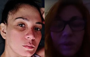 Dramático relato de una amiga de Lowrdez Fernández: “El golpeador le pegó en las costillas y tiene la cabeza muy lastimada” Dramático relato de una amiga de Lowrdez Fernández: “El golpeador le pegó en las costillas y tiene la cabeza muy lastimada”