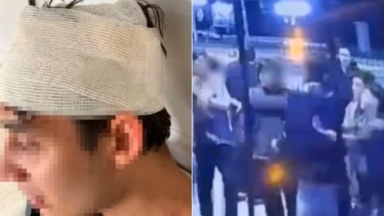 Un joven denunció golpiza de rugbiers cordobeses en Mendoza Un joven denunció golpiza de rugbiers cordobeses en Mendoza