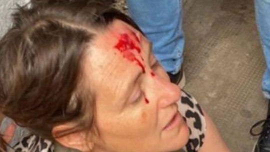 Violencia en las escuelas: una preceptora terminó herida cuando intentó separar una pelea entre estudiantes