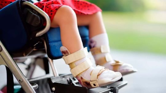 La Atrofia Muscular Espinal ya tiene una terapia, pero aún no está en Argentina