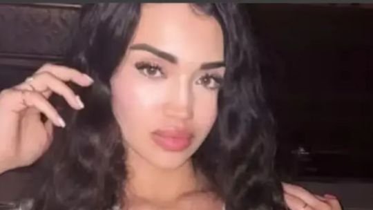 Autopsia con datos parciales: qué se sabe sobre la muerte de Narela Barreto en Los Ángeles