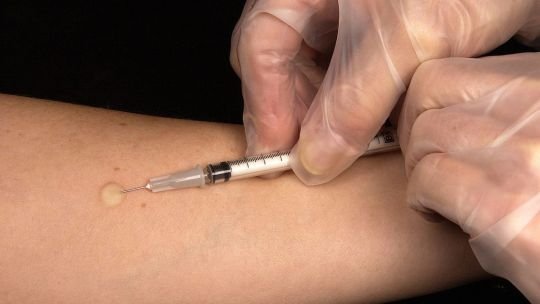 Oscar Atienza: “Todas las enfermedades evitables por vacuna están todas en aumento”