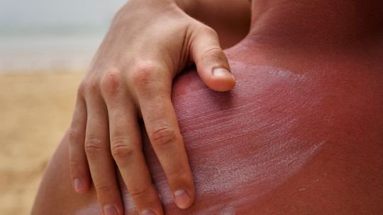 Índice UV bajo en Argentina: un respiro invernal ideal para la salud sin riesgos extremos