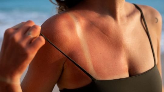El índice de rayos UV se mantendrá bajo en gran parte del país y reduce el riesgo inmediato para la salud