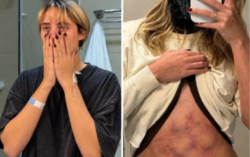 Se supo lo que nadie contó sobre Daniel Osvaldo y su internación en terapia intensiva: “Jimena Barón fue porque él tenía un montón de…”