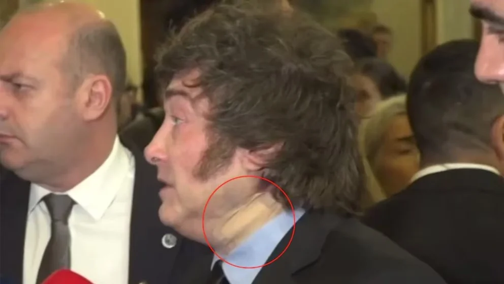 Qué le pasó a Javier Milei que apareció con un vendaje en el cuello