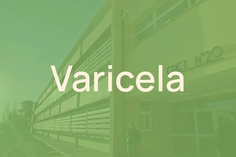 Salud y Educación monitorean dos brotes de varicela en dos escuelas de Neuquén capital